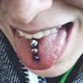 taths-piercing-waechtersbach-zungenpiercing-2
