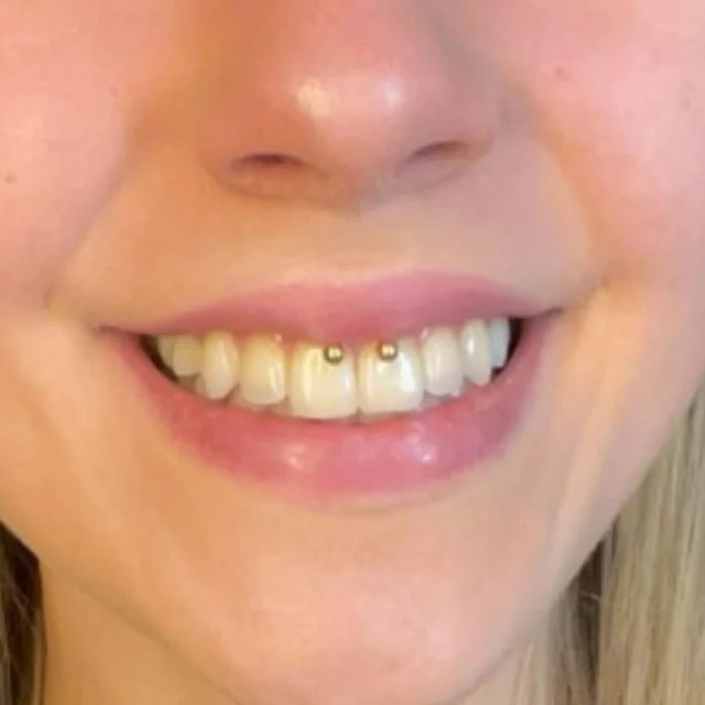 #smileypiercing #tathspiekswerkstatt #tathspiercing