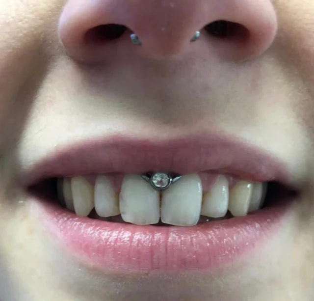 #septumpiercing #smilypiercing #tathspiekswerkstatt #wächtersbach